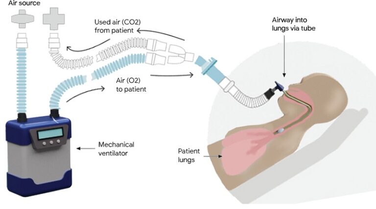 Machine Learning for Mechanical Ventilation Control
