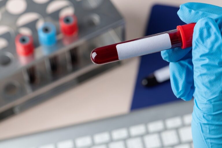Freenome and Exact Sciences Join Forces to Commercialize Groundbreaking Blood-Based CRC Test